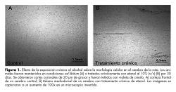 Efecto de la exposición crónica al alcohol sobre la morfología celular en el cerebro de la rata.