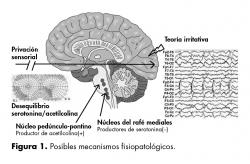 Posibles mecanismos fisiopatológicos.